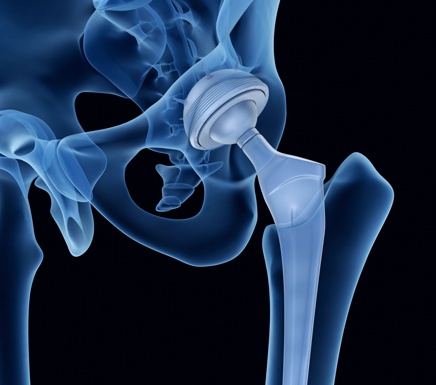 Innovative digitale Prothesenplanung Peekmed