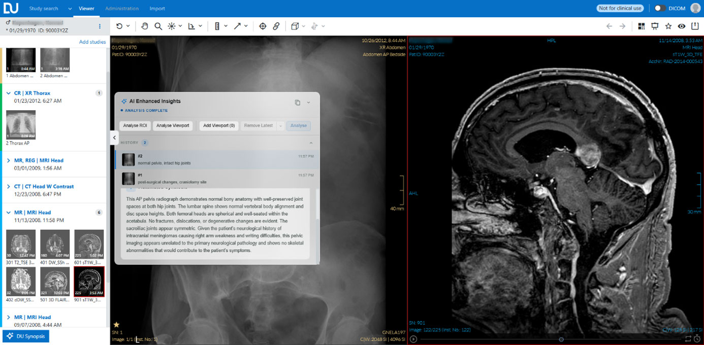 Die nächste Generation Ihrer Befundung beginnt hier.
Wir geben Ihnen vor dem RöKo 2026 einen Vorab-Einblick in fünf Entwicklungen rund um KI in Ihrem
radiologischen Workflow. Am Stand erwarten Sie eine Live-Demo und ein persönliches Gespräch. Wir
sind auf Ihre Meinung gespannt.