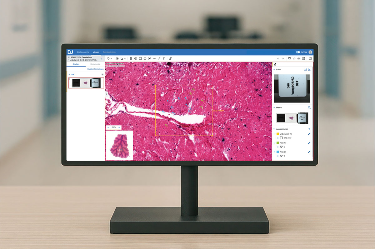 DeepUnity Viewer for Pathology – Entdecken Sie das volle Potenzial eines digitalen Workflows in der Pathologie​ Die Digitalisierung ist der Schlüssel für einen effizienteren Arbeitsablauf in vielen Bereichen; so auch in der Pathologie. Schneller Zugriff auf frühere Fälle, Bilder und Dokumente von überall und zu jeder Zeit, institutionenweit. DeepUnity Viewer for Pathology bietet Ihnen einen sicheren, webbasierten Zugang zu allen patientenbezogenen Bildern und Dokumenten für einen effizienteren Arbeitsablauf und ein einfacheres Content Management zur Erstellung Ihrer Diagnose.