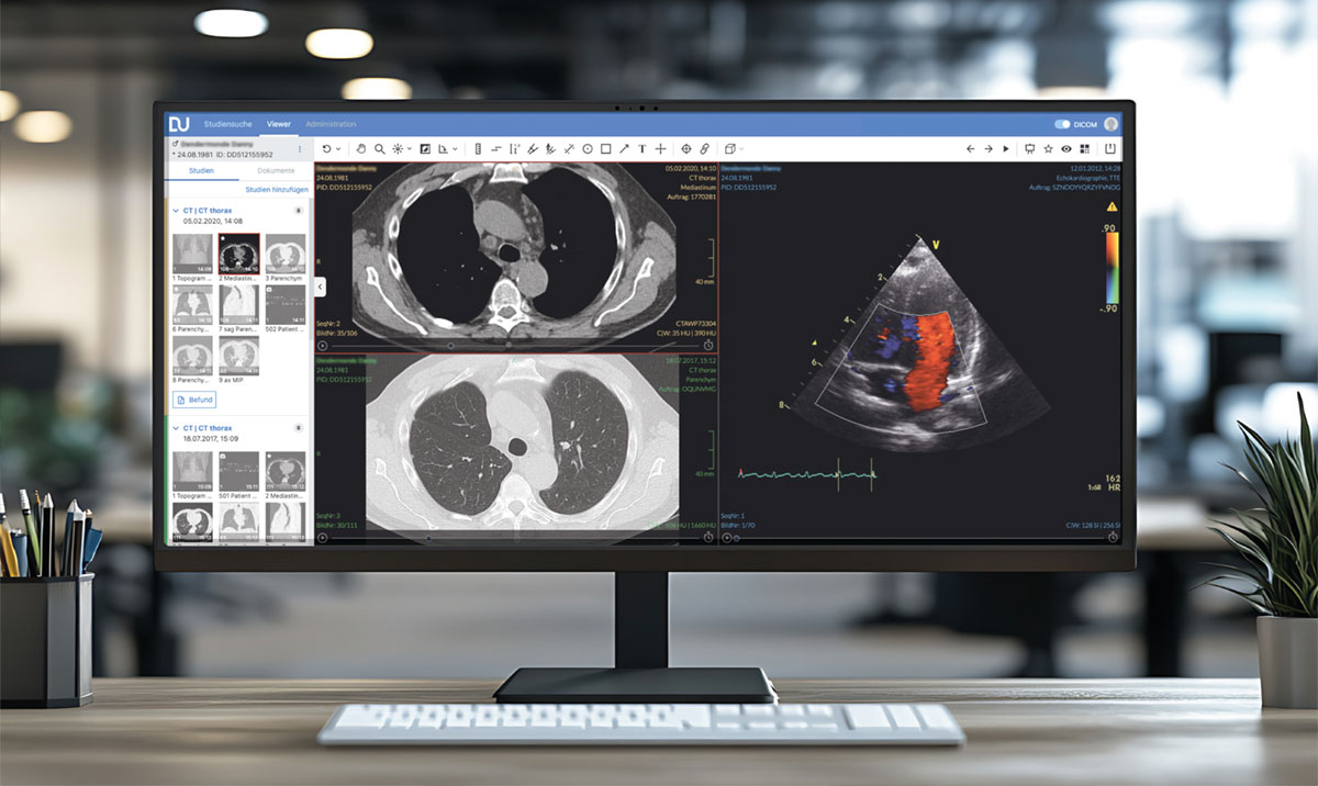 DeepUnity Viewer - Sicherer, schneller Zugriff auf alle medizinischen Daten von überall und zu jeder Zeit Die rasante Zunahme der Erstellung medizinischer Daten ist ein neuer Trend in der diagnostischen Bildgebung. Während es immer noch üblich ist, verschiedene Betrachtungssysteme für verschiedene Arten von medizinischen Daten zu verwenden, bieten wir eine einzige universelle Betrachtungslösung. DeepUnity Viewer wurde entwickelt, um Ihren natürlichen Workflow-Bedürfnissen gerecht zu werden und Ihnen einen sicheren Zugriff auf alle medizinischen Daten (DICOM und Nicht-DICOM) zu ermöglichen, um Ihnen einen ganzheitlichen Blick auf Ihren Untersuchungsfall zu geben, unabhängig davon, aus welchem System die Daten stammen. Der Zugang wird perfekt und einfach über einen Webbrowser verwaltet, während die Autorisierung über Keycloak erfolgt. Die moderne Technologie, auf der das Framework aufbaut, ermöglicht ein gewisses Maß an Skalierbarkeit und standardisierten Integrationen.