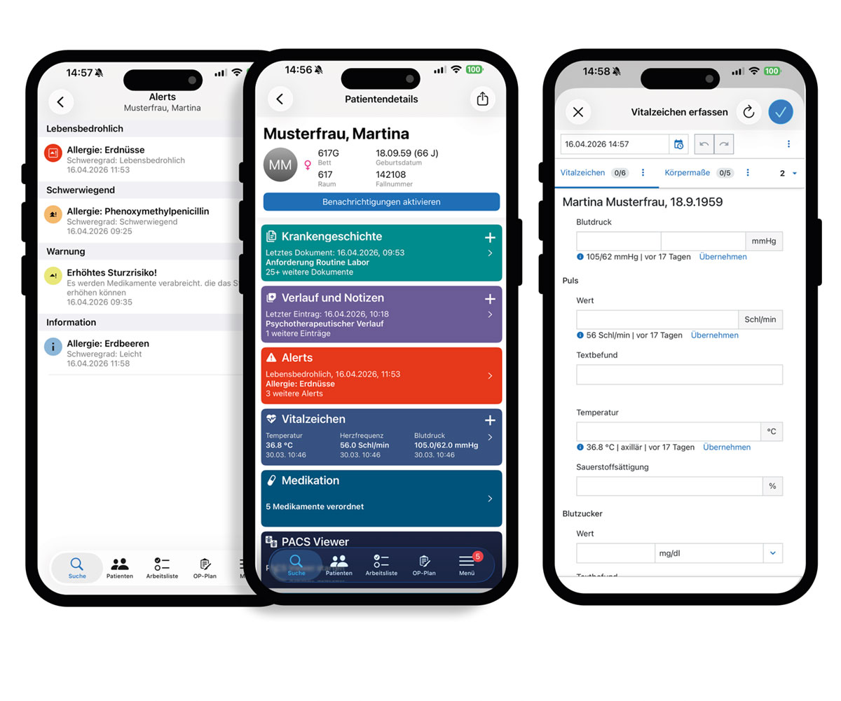 Mit ORBIS M erhalten Ärzte und Pflegekräfte mobilen Zugriff auf zentrale Patientendaten – flexibel nutzbar auf Smartphones und Tablets (iOS und Android). 

Die direkte Verfügbarkeit erhöht die Flexibilität im klinischen Alltag, beschleunigt Entscheidungen und spart wertvolle Zeit. 

Die Anwendung ist speziell für den Einsatz auf mobilen Endgeräten konzipiert und unterstützt eine schnelle, intuitive Nutzung – sowohl im Stationsalltag als auch im mobilen Einsatz. 