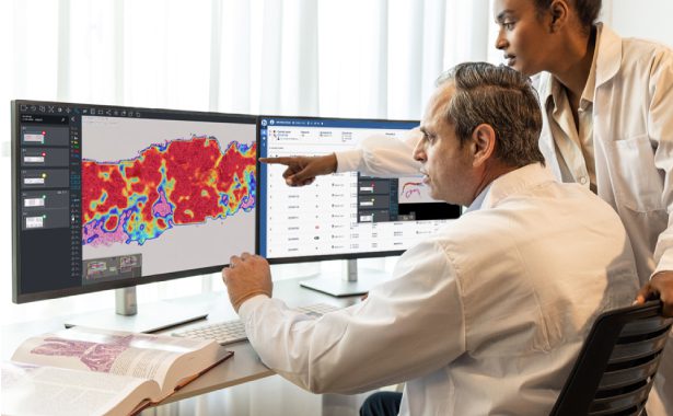 Dedalus e Ibex ofrecen una solución integral de patología digital impulsada por Inteligencia Artificial para agilizar el diagnóstico del cáncer en Europa